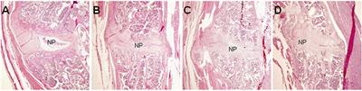 Testing if Micro-CT Is Capable of Quantitating the Extent of Proteoglycan-Aggrecan Induced Axial Spondyloarthritis in Mice